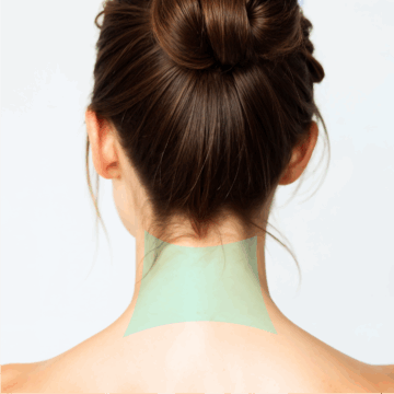 Cervical